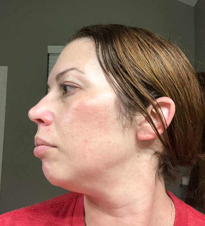 skin with dullness age spots woman in her late thirties side view no makeup
