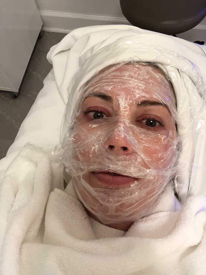 woman with towel covering her hair and plastic wrap on her face for numbing for vampire facial